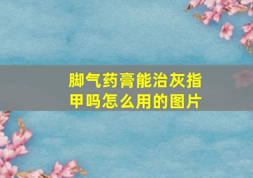 脚气药膏能治灰指甲吗怎么用的图片