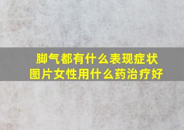 脚气都有什么表现症状图片女性用什么药治疗好