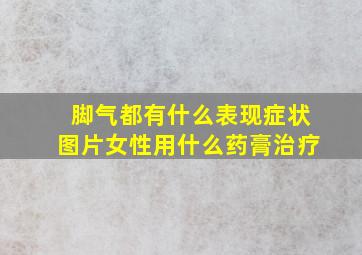 脚气都有什么表现症状图片女性用什么药膏治疗