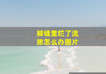 脚缝里烂了流脓怎么办图片