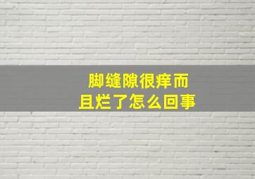 脚缝隙很痒而且烂了怎么回事