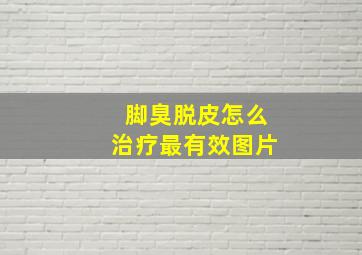 脚臭脱皮怎么治疗最有效图片