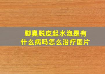 脚臭脱皮起水泡是有什么病吗怎么治疗图片