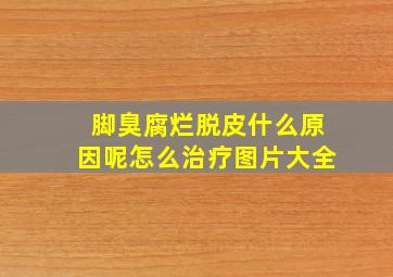 脚臭腐烂脱皮什么原因呢怎么治疗图片大全