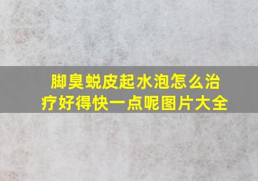 脚臭蜕皮起水泡怎么治疗好得快一点呢图片大全