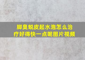 脚臭蜕皮起水泡怎么治疗好得快一点呢图片视频