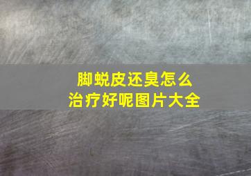 脚蜕皮还臭怎么治疗好呢图片大全