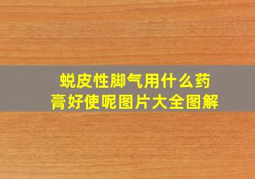 蜕皮性脚气用什么药膏好使呢图片大全图解