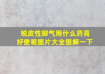 蜕皮性脚气用什么药膏好使呢图片大全图解一下