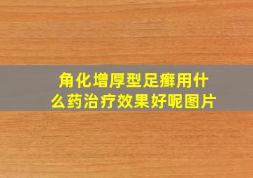 角化增厚型足癣用什么药治疗效果好呢图片