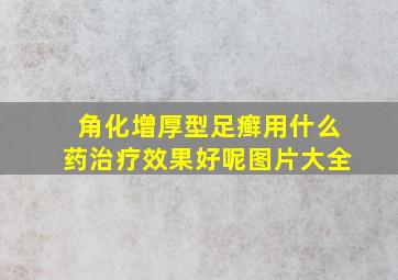 角化增厚型足癣用什么药治疗效果好呢图片大全