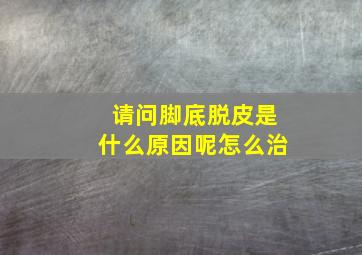 请问脚底脱皮是什么原因呢怎么治