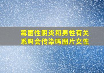 霉菌性阴炎和男性有关系吗会传染吗图片女性