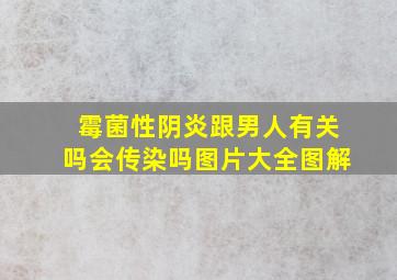 霉菌性阴炎跟男人有关吗会传染吗图片大全图解