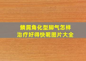 鳞屑角化型脚气怎样治疗好得快呢图片大全